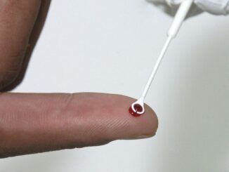 Anvisa, Agência Nacional de Vigilância Sanitária, HIV, Vírus da Imunodeficiência Humana, pré-exposição (PrEP), Vírus da imunodeficiência humana