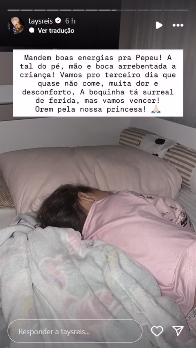  Cantora Tays Reis relata sintomas da Síndrome Mão-Pé-Boca na filha

